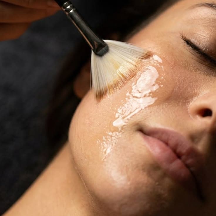 Alumier Peels
