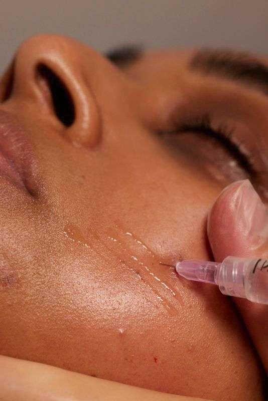 Mesotherapy & Skin Boosters